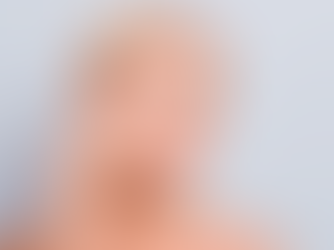 Can Microneedling With PRP Help Clear Up Acne Scars?