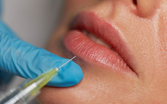female-recieving-lip-filler