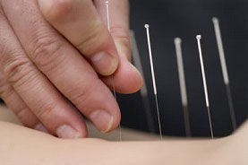 Acupuntura e Reiki agora têm explicação científica!