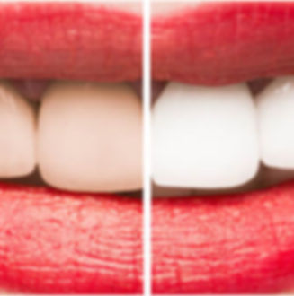 perfect-smile.001-1024x330.jpeg
