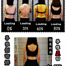 Scoliosis02.jpeg