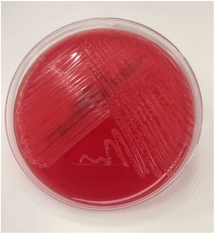 Prazer, você conhece o Streptococcus agalactiae?