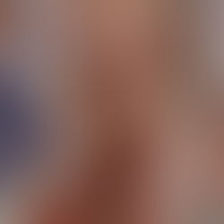 Put on the surgical protective gown and wear As One 40cm size S latex gloves.