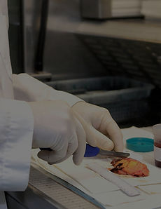 _A lab technician dissects a human appen
