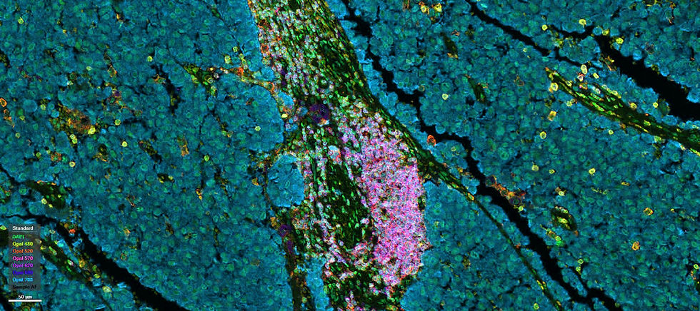 Research-Focus_Cancer_Levesque-Lab_Scan_Color.jpg