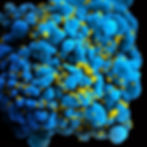 A colorized image of a white blood cell that has been infected with HIV.