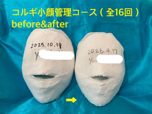 コルギ小顔管理ビフォーアフター