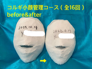 コルギ小顔管理ビフォーアフター