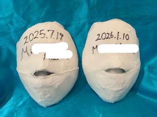 骨盤の歪みは顔の歪み