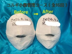 コルギ小顔管理コース(全16回)ビフォーアフター