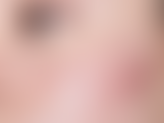What is Acne? Best Acne Treatments and Top skincare products for Acne-Prone Skin