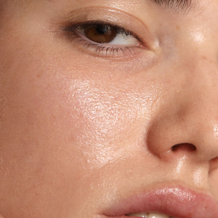What is Oily Skin? Best Skincare Guide for Oily Skin