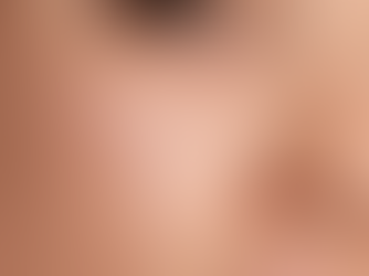 What is Oily Skin? Best Skincare Guide for Oily Skin