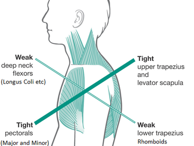 What Is Your Shoulder Pain?