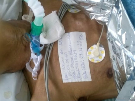 Polícia investiga caso de idoso dado como morto, mas estava vivo na funerária em Goiás