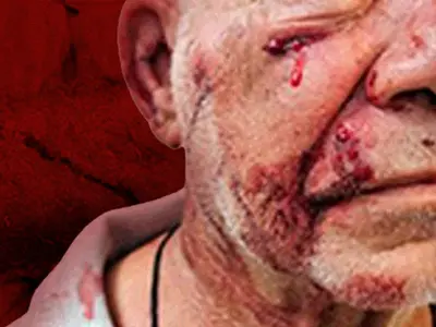 Veja como ficou servidor de 73 anos agredido por policial no INSS