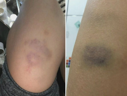 Adolescente de 16 anos é suspeito de estuprar cunhada e agredir namorada, em Corumbá de Goiás