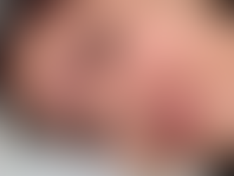 Em Goiás, Mulher tem rosto machucado e denuncia agressão em festa no Entorno