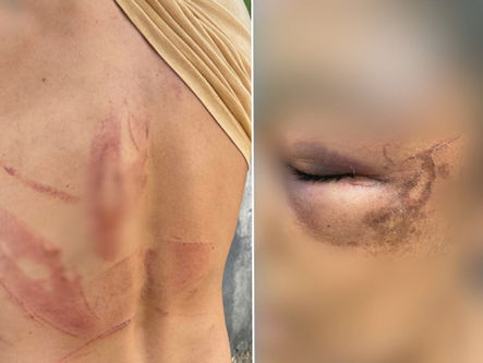 Casal denuncia que foi agredido com facão e tapas por fazendeiro e esposa, em Goiás