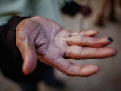 Fome: juíza solta homem que furtou carne por não ter o que comer em Goiás