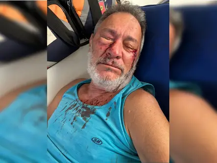 Motorista de aplicativo agride idoso após colisão em Samambaia
