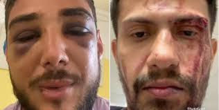 Casal gay é espancado dentro de banheiro de bar do DF por 8 homens