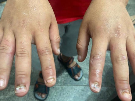Pai preso suspeito de torturar filho confessou que sentia prazer em agredir a criança, Em Goiás