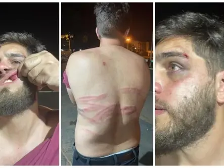 Roubo, socos e invasão: briga entre petistas vai parar na delegacia no DF