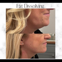 Essence Medical - Fat Dissolving