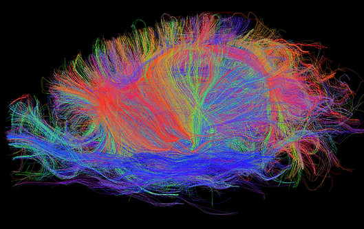 this is a diffusion MR scan of a mouse brain