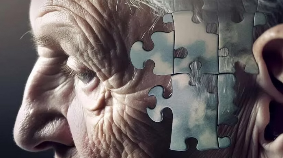 Enfermedad de Huntington: una mirada hacia una enfermedad devastadora