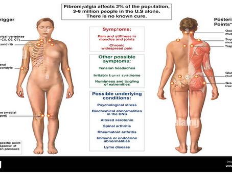 Abordando la Fibromialgia desde una perspectiva neuropsicológica