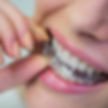 Invisalign in Whittier