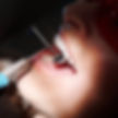 Root Canal at Whittier