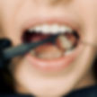 Wisdom Tooth in Whittier