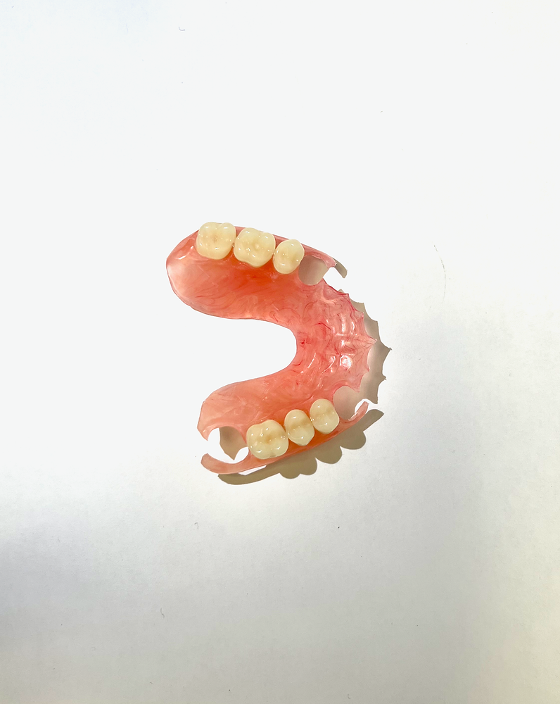 Valplast Based Rpd Benefits Of Valplast Flexible Partial Dentures – LKBJ