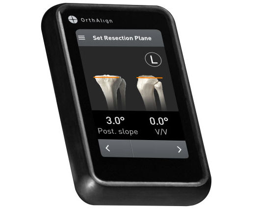 OrthAlign's CEO on The Future of Digital Technologies in Orthopedics 