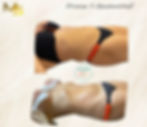 Copie de Copie de Copie de Lymphomodelling(3)_edited_edited