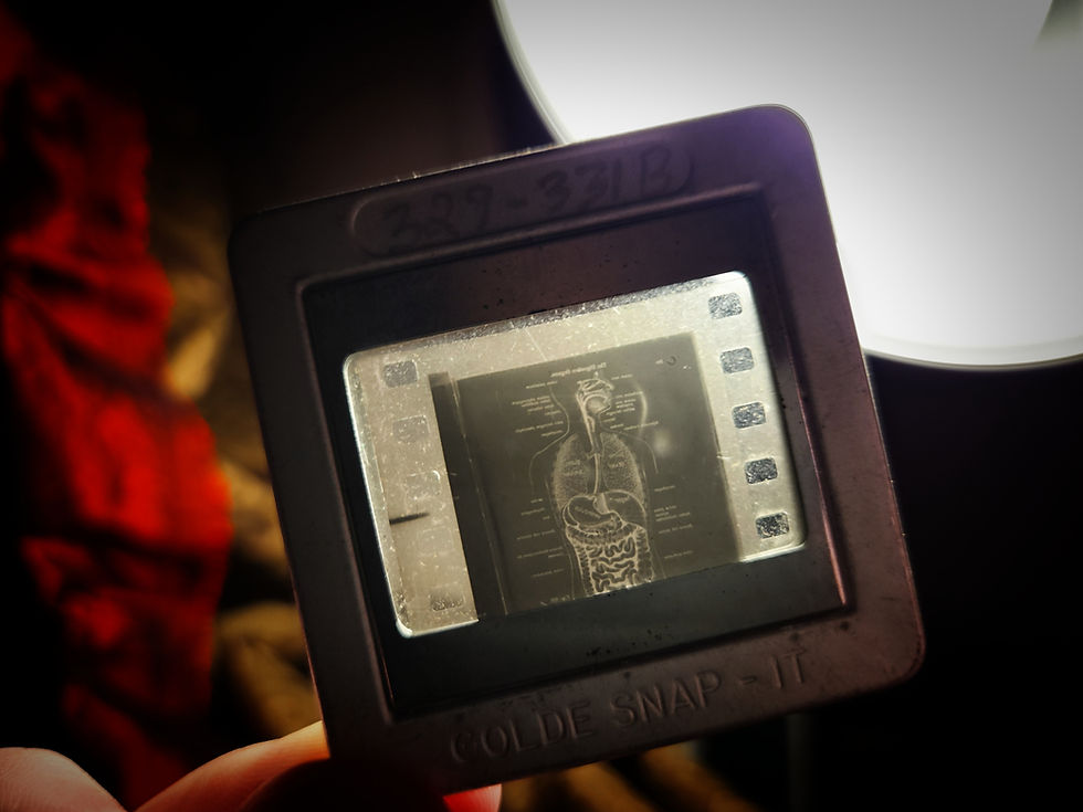 Thumbnail: 1940s/1950s Lot of 25 Medical Anatomy Slides