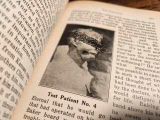 Test patient photo 2