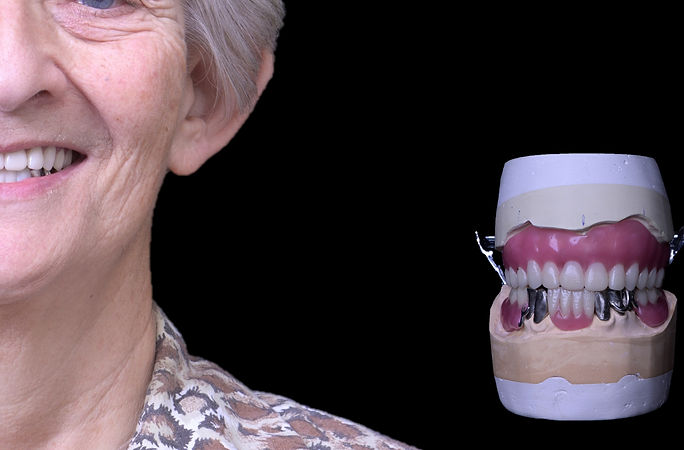 denture vs implant.jpg