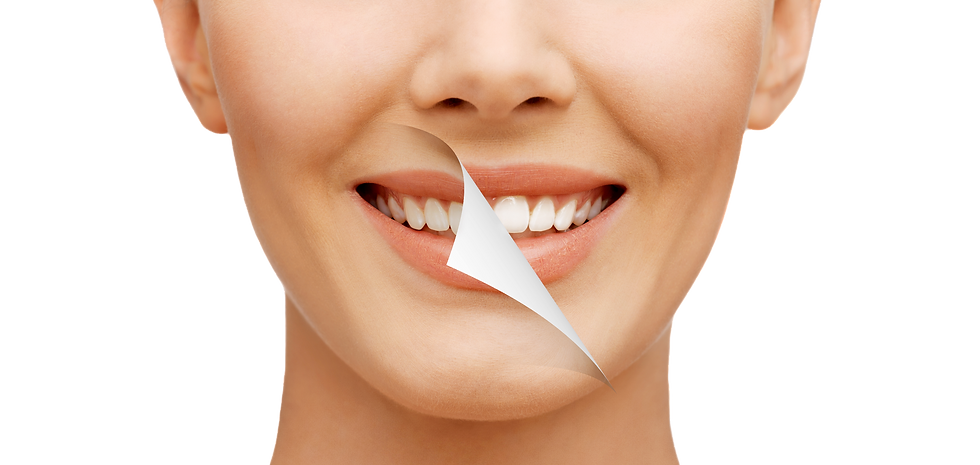 Teeth whitening smile makeover milton,