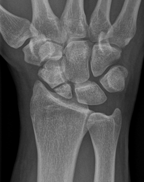 Dr. Philip Tomantschger
Facharzt für Unfallchirurgie
Spezialisierung in der Handchirurgie
Wahlarzt aller Kassen