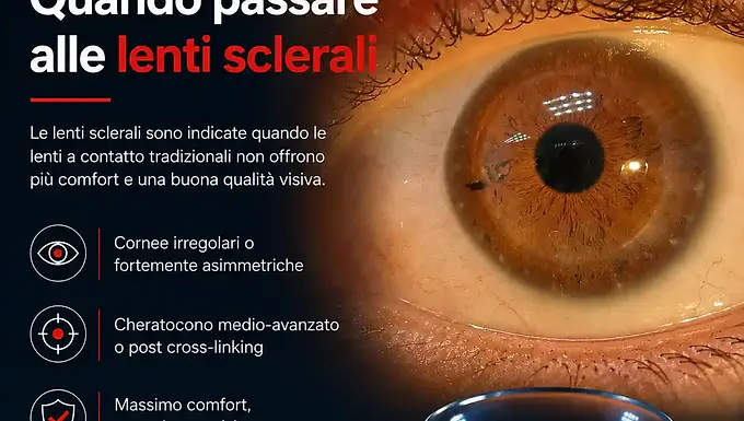 Quando passare alle lenti sclerali