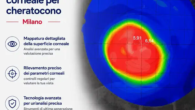 Topografia corneale per cheratocono Milano