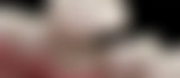 Why Choose A Dental Crown To Correct Your Smile?