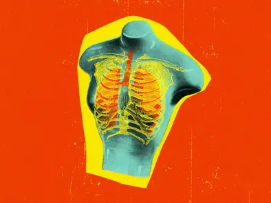 5 Reasons Your Chest Hurts That Have Nothing to Do With Your Heart