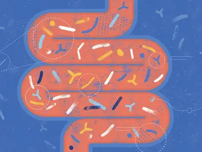 What to Know About Rising Colorectal Cancer Rates in Kids and Teens