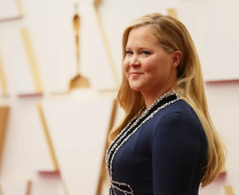 Amy Schumer Opened Up About Trichotillomania. Here’s What People With The Condition Think About That