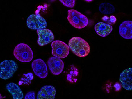 Ultrasound waves can be used to rejuvenate aging cells